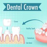 Discover the Secrets to Maintaining Robust Gums and Building Unbreakable Teeth!