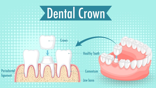 Discover the Secrets to Maintaining Robust Gums and Building Unbreakable Teeth!