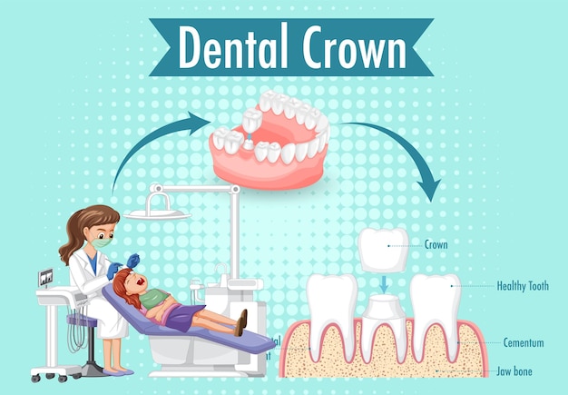 Unraveling the Mystery: Getting Braces and a Root Canal Simultaneously – What You Need to Know.